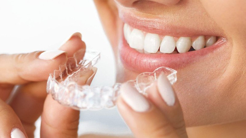 Here’s how to clean your Invisible Braces Effectively